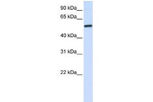Image no. 1 for anti-Aminolevulinate, delta-, Synthase 2 (ALAS2) (C-Term) antibody (ABIN2776924)