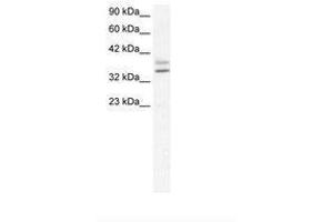 Image no. 1 for anti-Ets Homologous Factor (EHF) (AA 95-144) antibody (ABIN202193)