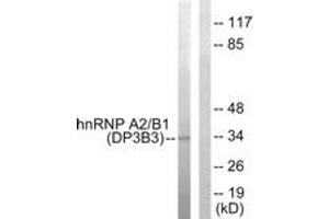 Image no. 1 for anti-Heterogeneous Nuclear Ribonucleoprotein A2/B1 (HNRNPA2B1) (AA 1-50) antibody (ABIN1533660)