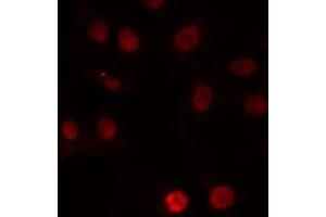 anti-DNA Repair Protein Complementing XP-G Cells (ERCC5) (N-Term) antibody