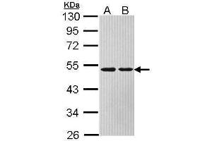 Image no. 5 for anti-Argininosuccinate Lyase (ASL) (Center) antibody (ABIN2856924)