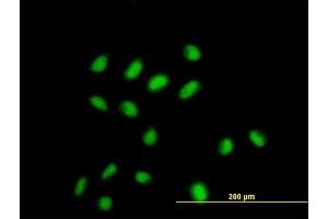 Image no. 3 for anti-Chromodomain Protein, Y-Like (CDYL) (AA 153-260) antibody (ABIN522877)