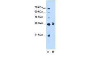 Image no. 1 for anti-Transcription Factor B1, Mitochondrial (TFB1M) (AA 151-200) antibody (ABIN324363)