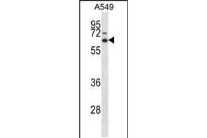 Image no. 1 for anti-Zinc Finger and SCAN Domain Containing 22 (ZSCAN22) (AA 198-227) antibody (ABIN5538388)