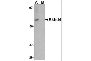 Image no. 2 for anti-Mex-3 Homolog A (MEX3A) (C-Term) antibody (ABIN500620)