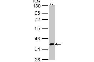 Image no. 1 for anti-Speckle-Type POZ Protein (SPOP-B) (Center) antibody (ABIN2856462)
