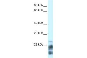 Image no. 1 for anti-Magnesium-Dependent Phosphatase 1 (MDP1) (N-Term) antibody (ABIN2785016)