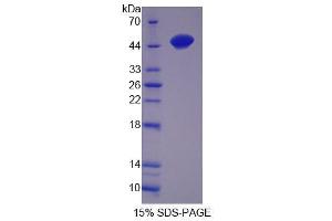 Image no. 1 for Tocopherol (Alpha) Transfer Protein (TTPA) (AA 88-253) protein (S tag,His tag) (ABIN6237523)
