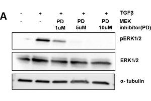 Image no. 13 for anti-alpha Tubulin (TUBA1) (C-Term) antibody (ABIN964563)