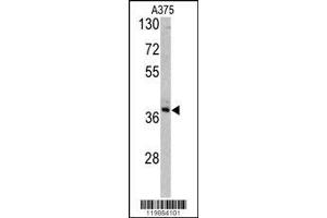 Image no. 1 for anti-Transaldolase 1 (TALDO1) (AA 186-215) antibody (ABIN390629)