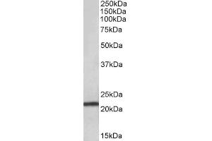 Image no. 2 for anti-Transmembrane Protein 205 (TMEM205) (AA 137-146) antibody (ABIN571264)