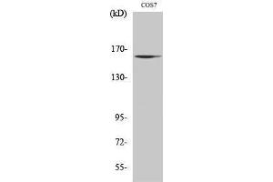 Image no. 1 for anti-MutS Homolog 6 (E. Coli) (MSH6) (Internal Region) antibody (ABIN3184960)