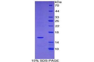 Tryptase delta 1 (TPSD1) protein