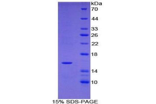 Tryptase delta 1 (TPSD1) protein