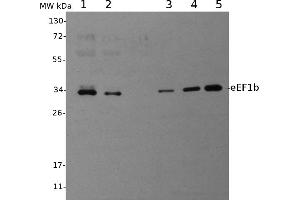 Image no. 1 for anti-Eukaryotic Translation Elongation Factor 1 beta 2 (EEF1B2) antibody (ABIN334557)
