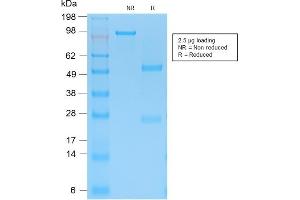 Image no. 1 for anti-Keratin 15 (KRT15) antibody (ABIN6939916)