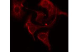 Image no. 2 for anti-Ribosomal Protein L12 (RPL12) (C-Term) antibody (ABIN6258526)