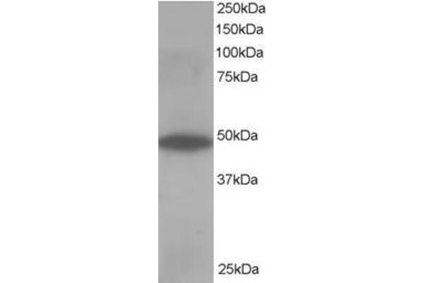 OSBPL1A Antikörper  (C-Term)