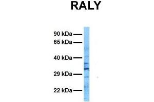 Image no. 3 for anti-RNA-binding protein Raly (RALY) (N-Term) antibody (ABIN2778251)
