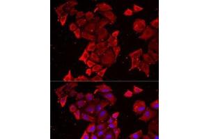 Immunofluorescence analysis of MCF7 cells using TIMM17A Polyclonal Antibody