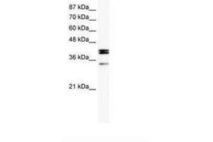Image no. 1 for anti-Nuclear Receptor Subfamily 5, Group A, Member 1 (NR5A1) (AA 174-223) antibody (ABIN202573)