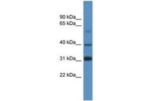 Image no. 1 for anti-SRY (Sex Determining Region Y)-Box 1 (SOX1) (AA 313-362) antibody (ABIN6746081)