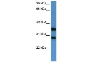 Image no. 1 for anti-serine/threonine/tyrosine Interacting-Like 1 (STYXL1) (Middle Region) antibody (ABIN926480)