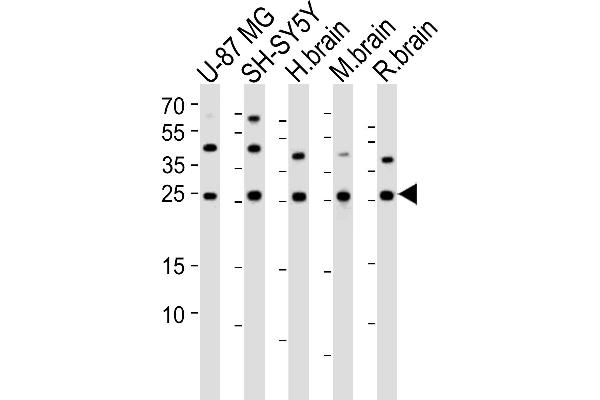 STMN2 抗体  (N-Term)