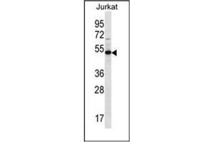 Image no. 1 for anti-Family with Sequence Similarity 8, Member A1 (FAM8A1) (AA 94-133), (N-Term) antibody (ABIN952155)