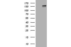 Image no. 5 for anti-Mast/stem Cell Growth Factor Receptor (KIT) (AA 546-976) antibody (ABIN1491585)