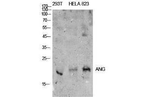 Image no. 1 for anti-Angiotensinogen (serpin Peptidase Inhibitor, Clade A, Member 8) (AGT) (Internal Region) antibody (ABIN3181398)