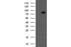 Image no. 6 for anti-Coagulation Factor XIII, A1 Polypeptide (F13A1) antibody (ABIN1498146)
