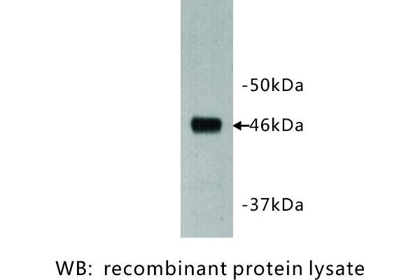 DCHS1 抗体