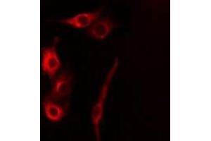Image no. 2 for anti-Caspase 5, Apoptosis-Related Cysteine Peptidase (CASP5) antibody (ABIN6260475)