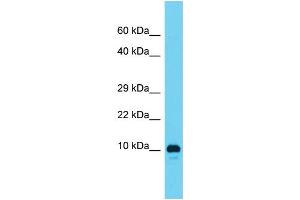 Image no. 1 for anti-Adipogenesis Associated Mth938 Domain Containing (AAMDC) (N-Term) antibody (ABIN2786179)