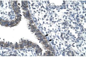 Image no. 3 for anti-CCR4 Carbon Catabolite Repression 4-Like (CCRN4L) (N-Term) antibody (ABIN2779705)