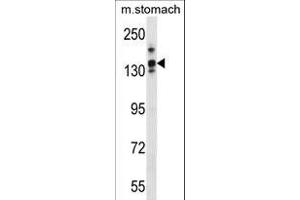 LRRC16A 抗体  (C-Term)