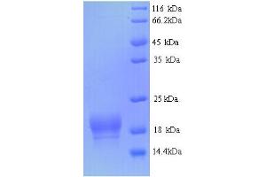 Image no. 1 for Fragile Histidine Triad (FHIT) (AA 2-150) protein (His tag) (ABIN5714304)