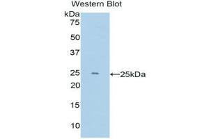 Image no. 1 for anti-Lysine (K)-Specific Demethylase 4C (KDM4C) (AA 685-871) antibody (ABIN1176553)