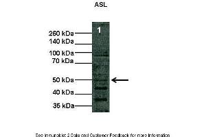 Image no. 2 for anti-Argininosuccinate Lyase (ASL) (Middle Region) antibody (ABIN2776928)