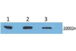 Image no. 2 for anti-Programmed Cell Death 6 Interacting Protein (PDCD6IP) (AA 463-732) antibody (ABIN2862598)