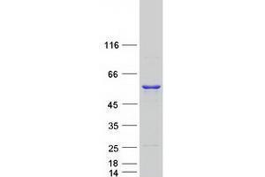 Image no. 1 for UDP-N-Acteylglucosamine Pyrophosphorylase 1 (UAP1) protein (Myc-DYKDDDDK Tag) (ABIN2734747)
