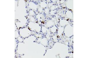 S100A9 anticorps  (AA 1-114)