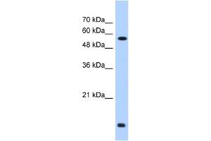Image no. 1 for anti-Prolyl 4-Hydroxylase, beta Polypeptide (P4HB) (C-Term) antibody (ABIN2783246)