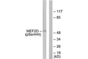 Western blot analysis of extracts from HepG2 cells treated with forskolin 40nM 30', using MEF2D (Phospho-Ser444) Antibody.