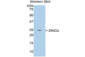 Image no. 1 for anti-RalA Binding Protein 1 (RALBP1) (AA 192-380) antibody (ABIN1176607)