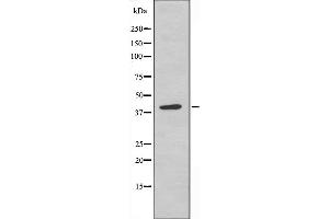 Image no. 1 for anti-Moloney Sarcoma Oncogene (MOS) (Internal Region) antibody (ABIN6258432)