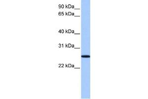 Image no. 1 for anti-F-Box Protein 36 (FBXO36) antibody (ABIN2459654)