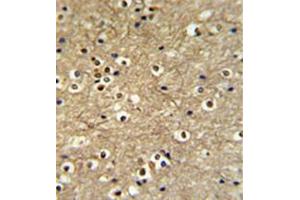 Image no. 2 for anti-V-Ets Erythroblastosis Virus E26 Oncogene Homolog 2 (ETS2) (AA 152-182), (Middle Region) antibody (ABIN952131)