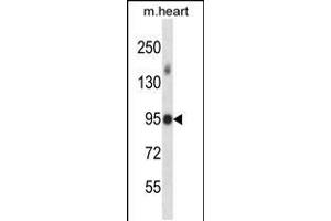 Image no. 2 for anti-Mitogen-Activated Protein Kinase Kinase Kinase MLK4 (KIAA1804) (AA 566-593) antibody (ABIN5539283)